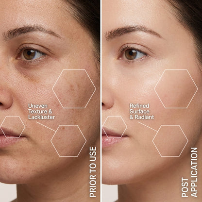 The Best Sonic Dermaplaner for Women Over 35